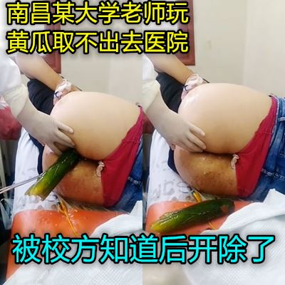 The real Nanjing one hooked woman into the anus can't pull out of the eggpoon was sent to the hospital to take out
